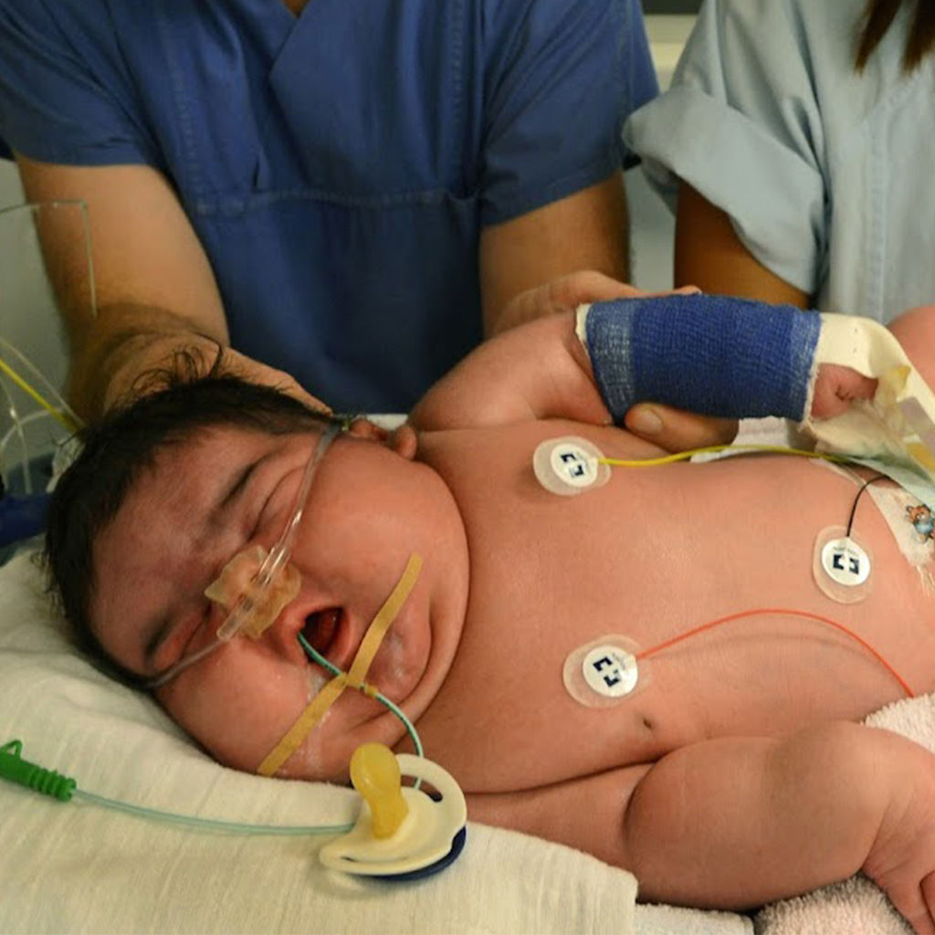 Mother Gives Birth to 13.47 Pound Girl in Germany 2