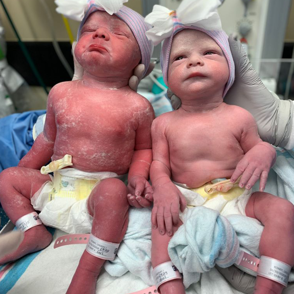 congratulations-twins-are-here-at-35-weeks-baby-and-mom-story