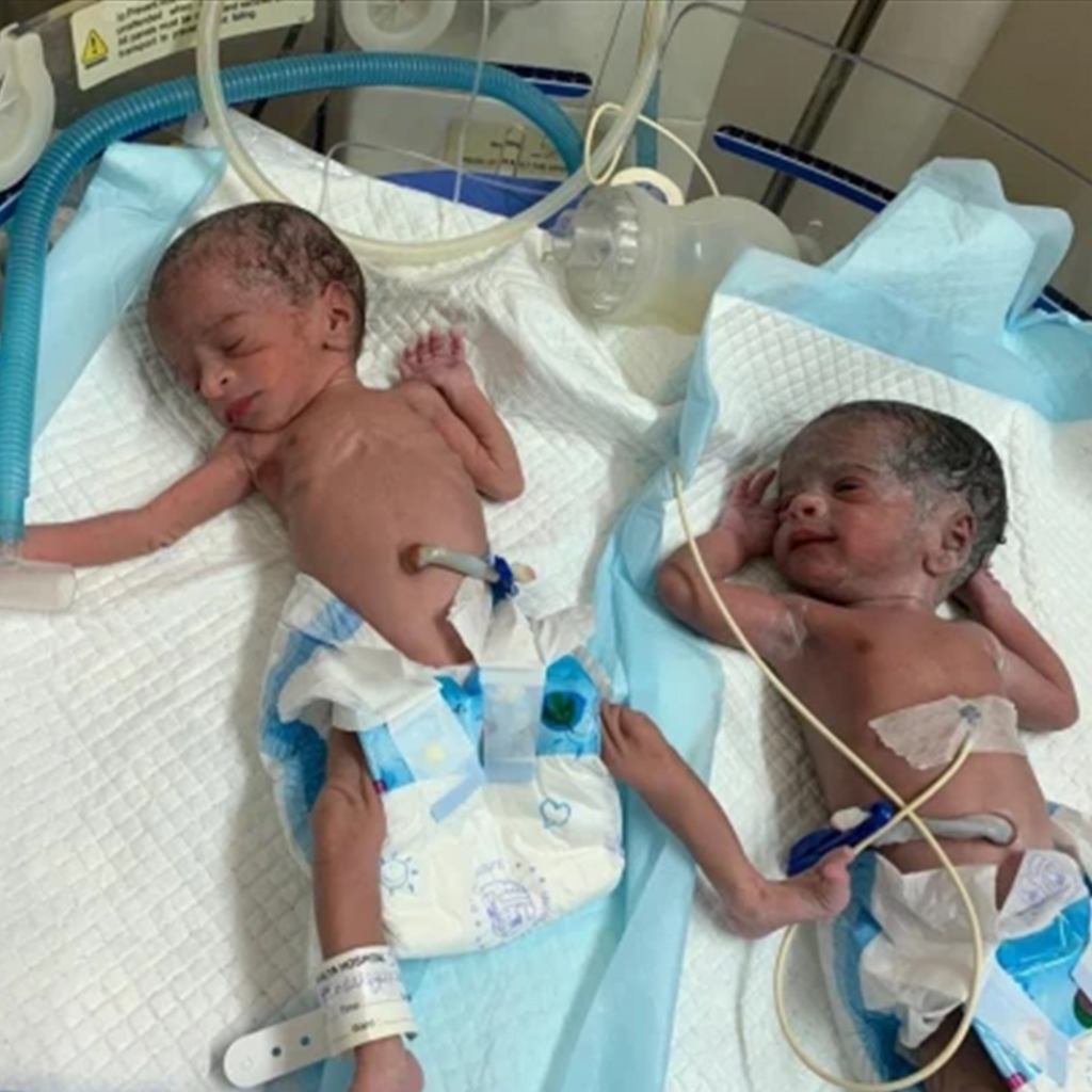 World Record Twins Born To A 74 Year Old Woman Baby And Mom Story